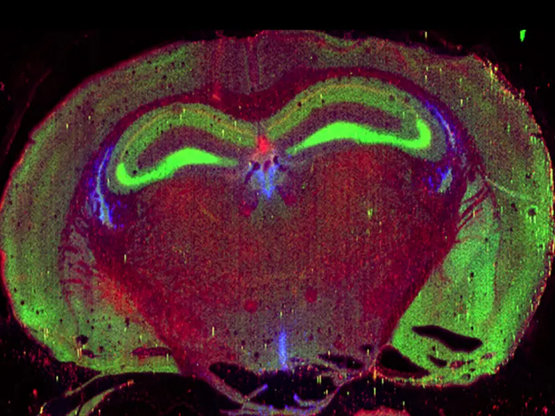 Mouse Brain - A cross sectional image of age related changes of Fe (red), Zn (green) and Cu (blue) in mouse brain using a 10 μm spot, 100 Hz repetition rate. Image area: Area of 5.5 x 4.5 mm. Analysis time of 41 minutes.